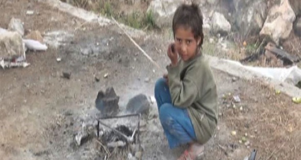 Tek göz barakada yaşam mücadelesi - 5