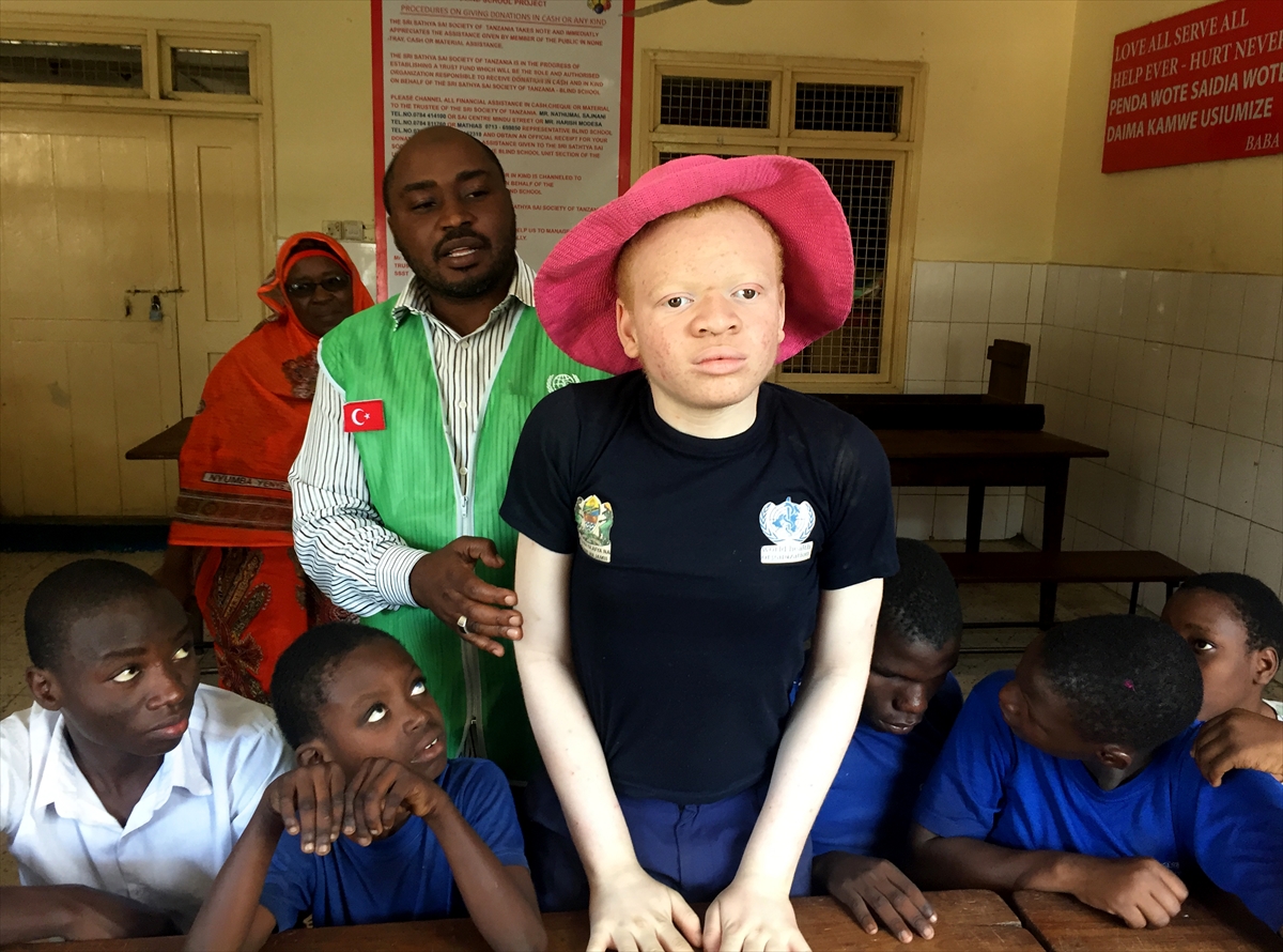 Afrika'nın beyaz insanları: Albinolar - 829