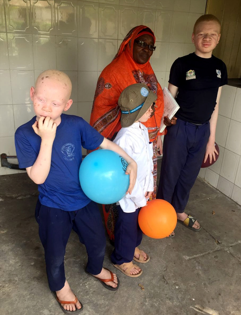 Afrika'nın beyaz insanları: Albinolar - 576