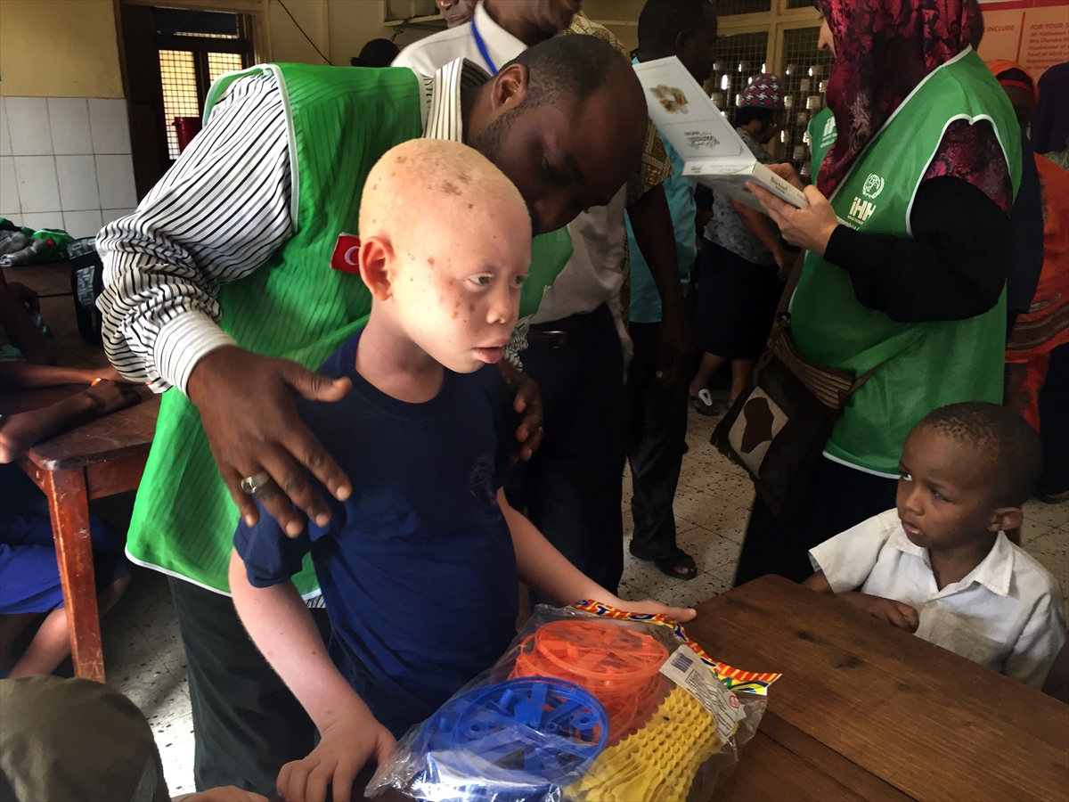 Afrika'nın beyaz insanları: Albinolar - 628