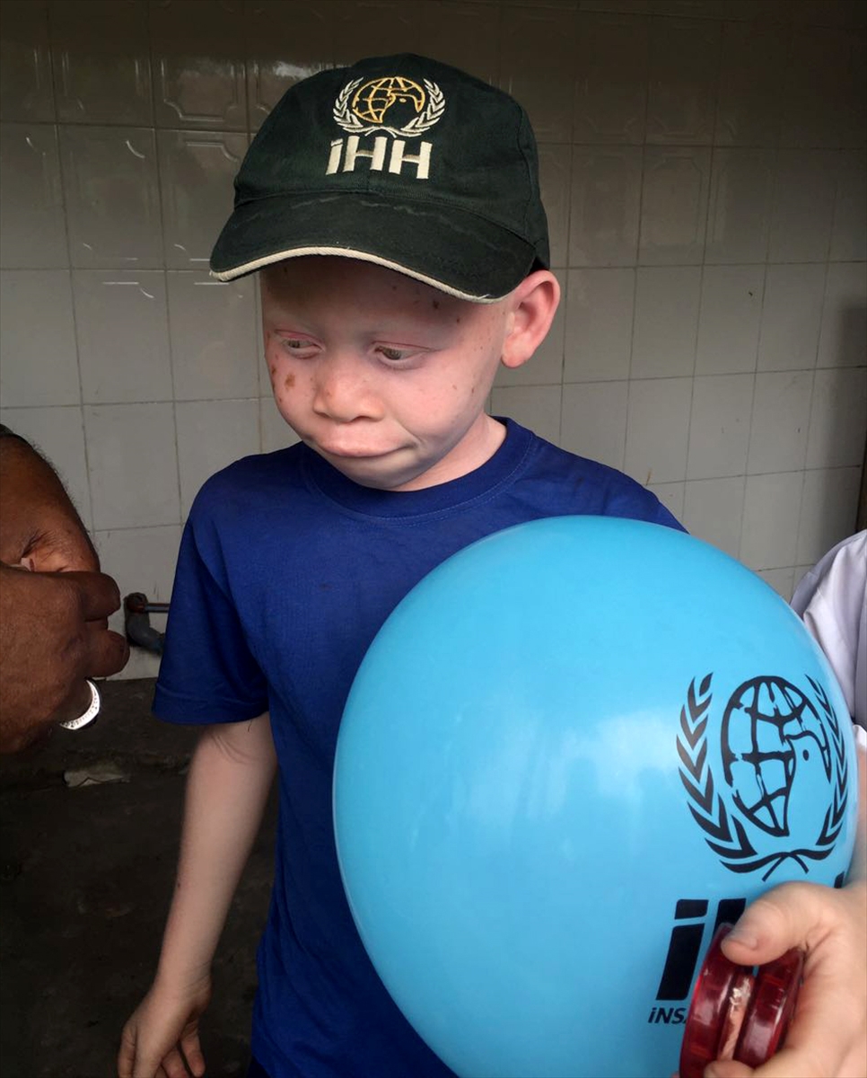 Afrika'nın beyaz insanları: Albinolar - 595