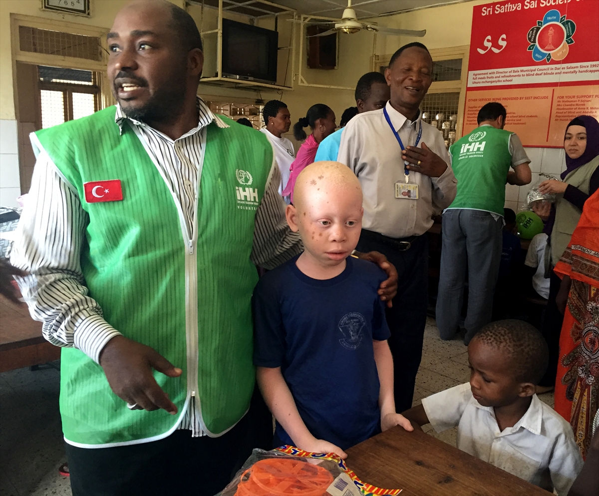 Afrika'nın beyaz insanları: Albinolar - 582