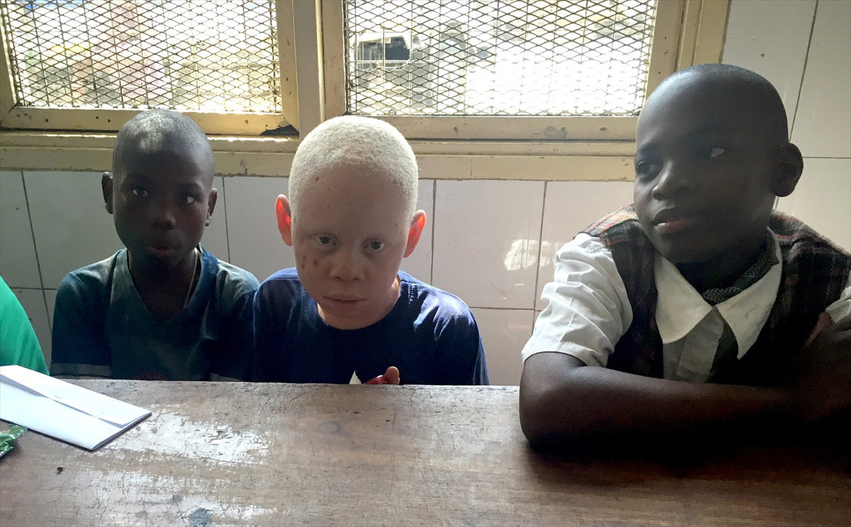 Afrika'nın beyaz insanları: Albinolar - 597