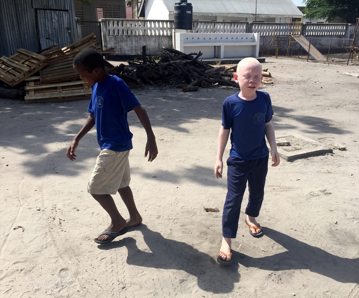 Afrika'nın beyaz insanları: Albinolar - 702