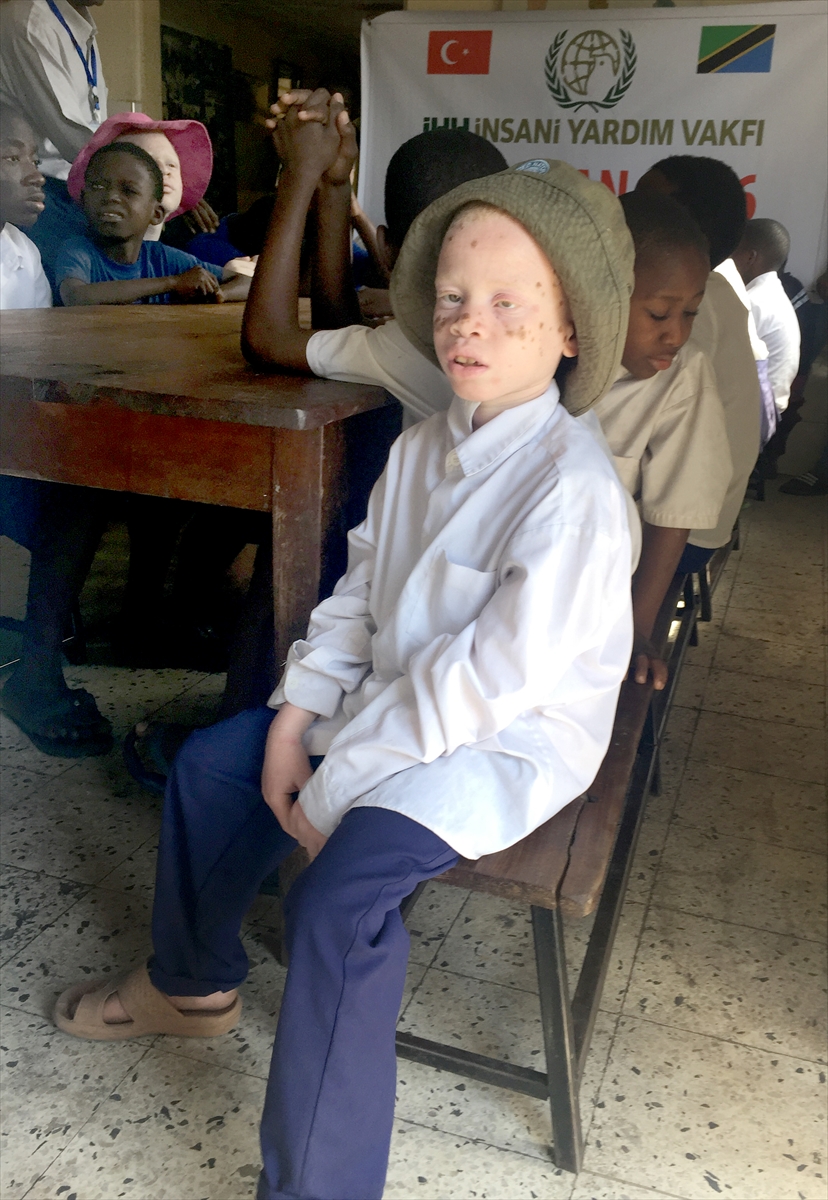 Afrika'nın beyaz insanları: Albinolar - 552