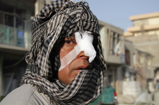 Afganistan’da intihar saldırısı - 5