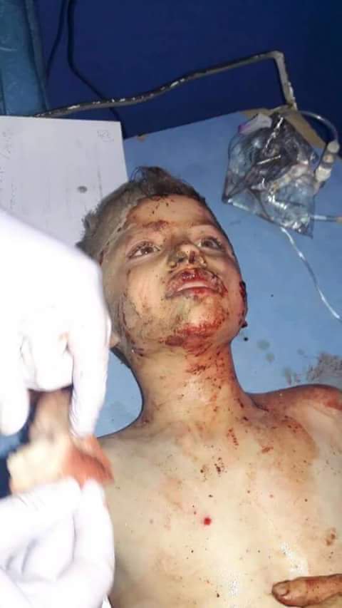 Halep'te katliam var... - 608