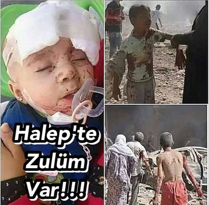 Halep'te katliam var... - 807