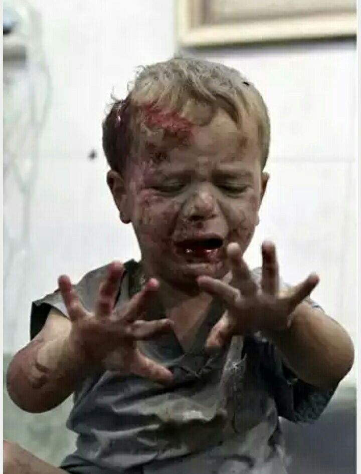 Halep kan ağlıyor! - 4