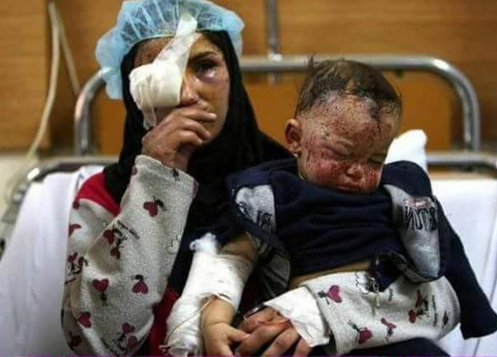 Halep kan ağlıyor! - 1