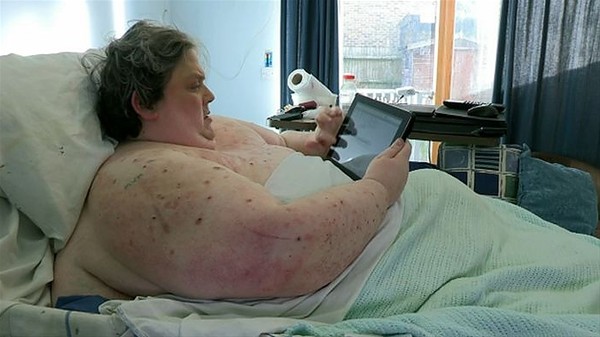 Şaşırtan röntgenler - 13