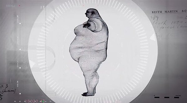 Şaşırtan röntgenler - 15