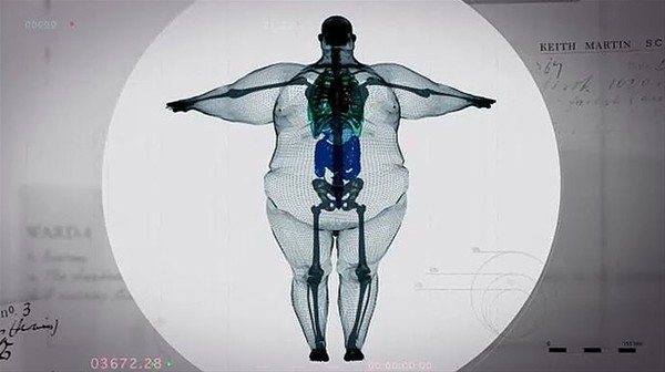 Şaşırtan röntgenler - 16