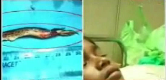 Şaşırtan röntgenler - 18