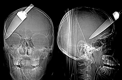 Şaşırtan röntgenler - 25