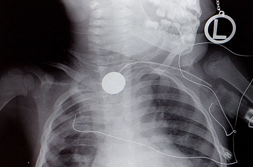 Şaşırtan röntgenler - 26