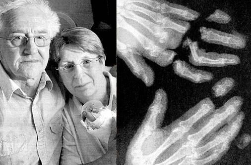 Şaşırtan röntgenler - 30