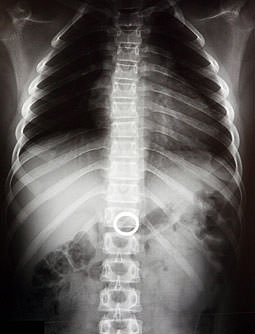 Şaşırtan röntgenler - 31