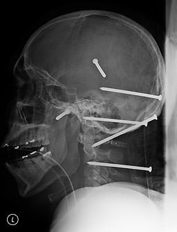 Şaşırtan röntgenler - 37