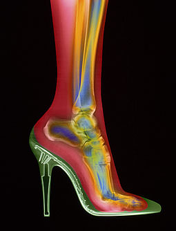 Şaşırtan röntgenler - 41