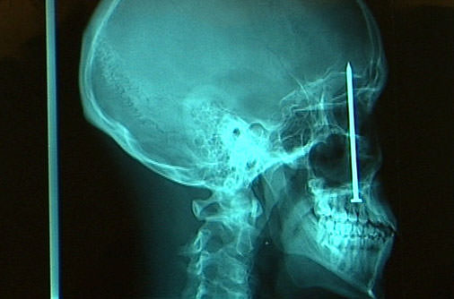 Şaşırtan röntgenler - 42