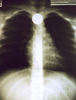 Şaşırtan röntgenler - 27