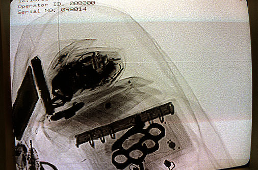 Şaşırtan röntgenler - 44