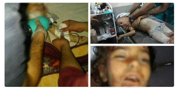 ABD Suriye'de çocukları böyle vurdu - 8