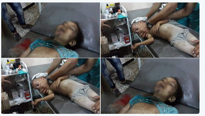 ABD Suriye'de çocukları böyle vurdu - 6