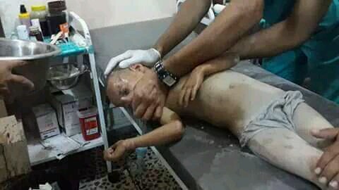 ABD Suriye'de çocukları böyle vurdu - 9