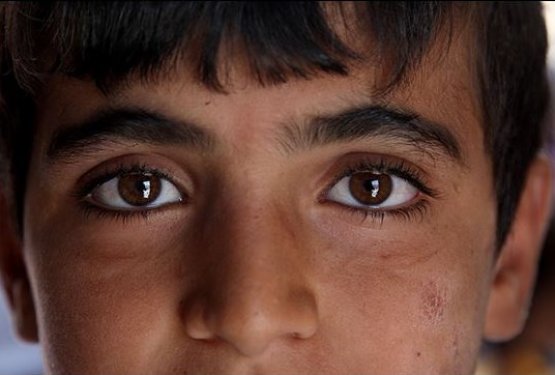 Çatışmaların savunmasız mağduru çocuklar... - 14