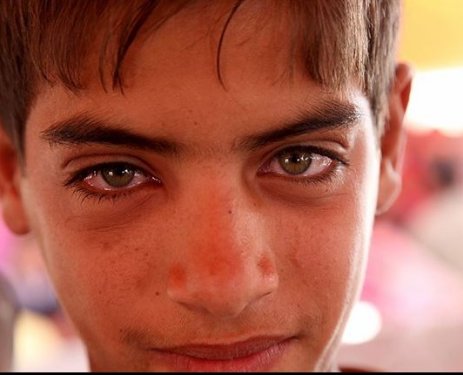 Çatışmaların savunmasız mağduru çocuklar... - 16