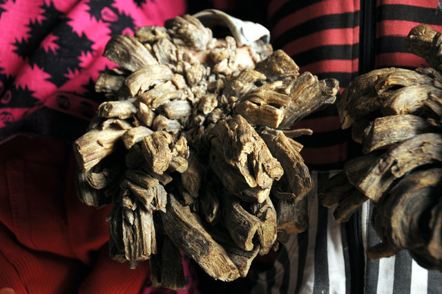 'Ağaç adam' tedavi oldu! - 2