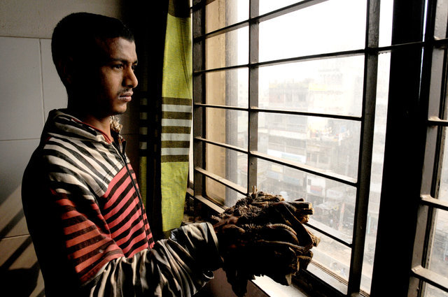 'Ağaç adam' tedavi oldu! - 5