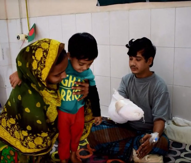 'Ağaç adam' tedavi oldu! - 11