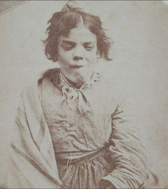 1800'lerin akıl hastanesinden tüyler ürperten fotoğraflar - 1