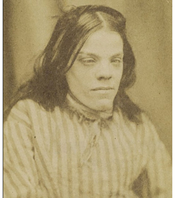 1800'lerin akıl hastanesinden tüyler ürperten fotoğraflar - 3