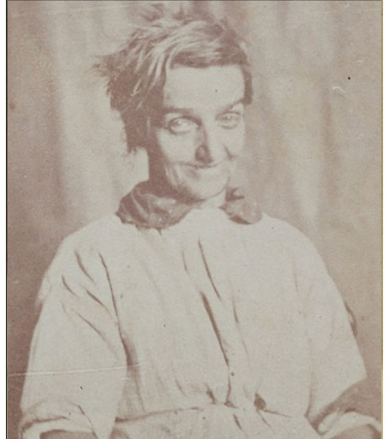 1800'lerin akıl hastanesinden tüyler ürperten fotoğraflar - 4