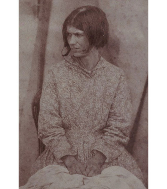 1800'lerin akıl hastanesinden tüyler ürperten fotoğraflar - 7