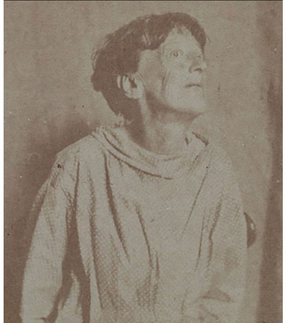 1800'lerin akıl hastanesinden tüyler ürperten fotoğraflar - 14