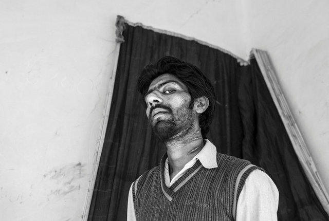 1800'lerin akıl hastanesinden tüyler ürperten fotoğraflar - 23