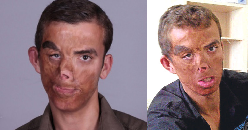 Yeni yüzü ve son haliyle Uğur Acar - 1