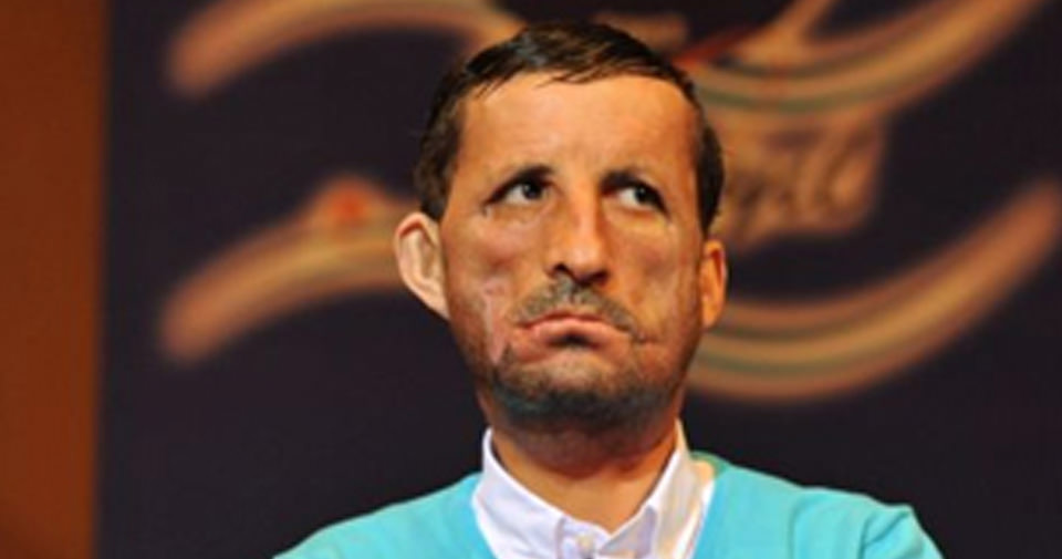 Yeni yüzü ve son haliyle Uğur Acar - 3