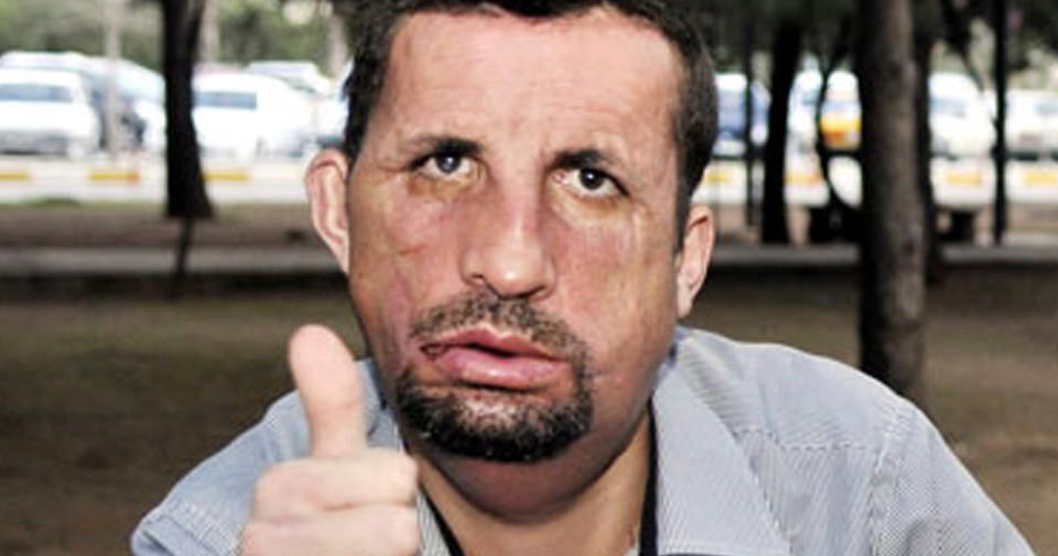 Yeni yüzü ve son haliyle Uğur Acar - 2