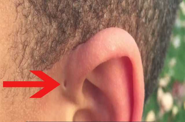 İnsan kulağının üzerinde yer alan delik nedir? - 1