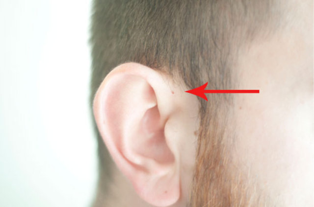 İnsan kulağının üzerinde yer alan delik nedir? - 4