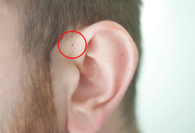 İnsan kulağının üzerinde yer alan delik nedir? - 8