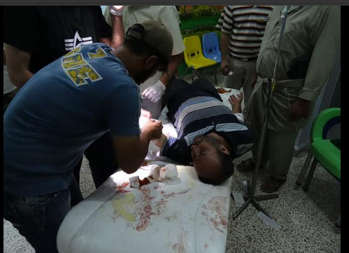 Esed güçleri yine sivilleri vurdu - 904