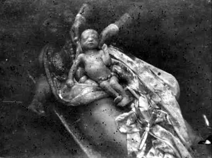 Çeyrek asırlık acı: Hocalı Katliamı - 14