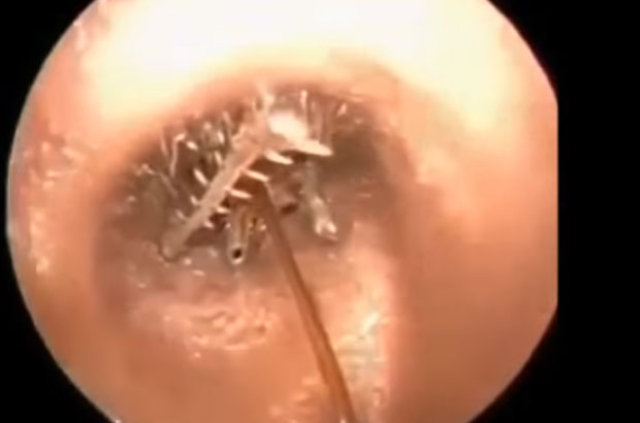 Kulağından öyle bir şey çıktı ki... - 3